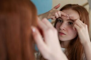 acne and self-esteem, a girl popping a pimple on her forehead